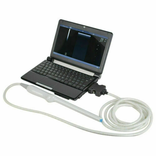 Portable Digital Laptop Ultrasound Scanner digital imaging technology w/ 2 Probe DIAGNOSTIC ULTRASOUND MACHINES FOR SALE