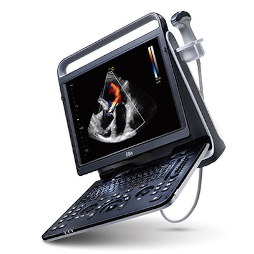 Chison eBit 60 Color Doppler Ultrasound Scanner & Cardiac CW, Vascular 7-18MHz DIAGNOSTIC ULTRASOUND MACHINES FOR SALE