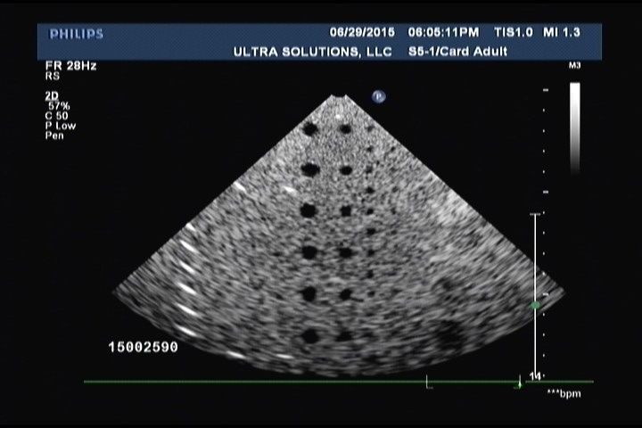 probe and ultrasound image