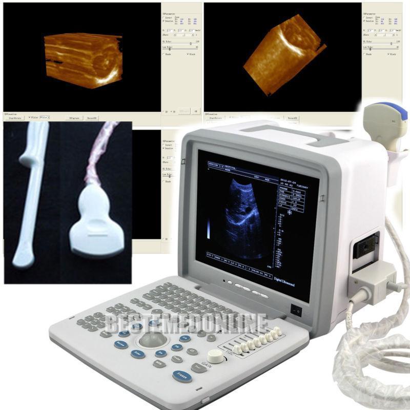 Ultrasound Unit Ultrasound Scanner/Machine Convex + Transvaginal 2 Probe 3D Sale DIAGNOSTIC ULTRASOUND MACHINES FOR SALE
