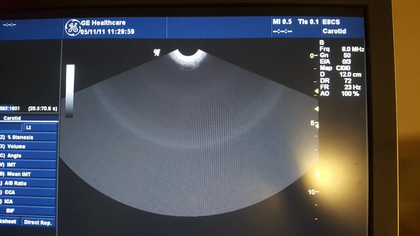 GE Logiq P6 Diagnostic Ultrasound unit OB/GYN/Abd DIAGNOSTIC ULTRASOUND MACHINES FOR SALE