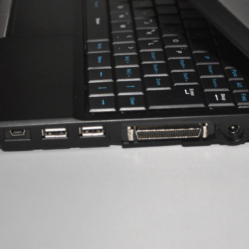 Digital Laptop Notebook Ultrasound Scanner+Convex+Linear+TranVagin Probe 10" LCD DIAGNOSTIC ULTRASOUND MACHINES FOR SALE