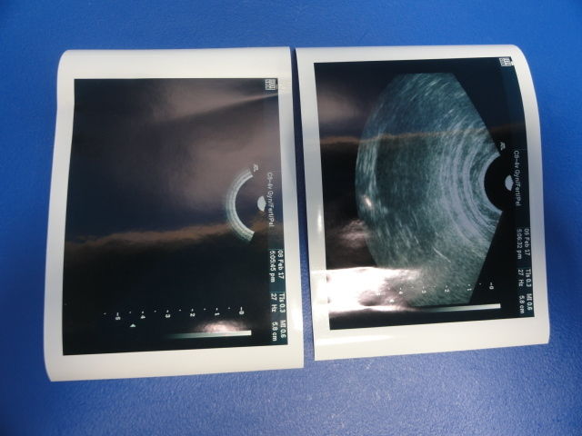 two ultrasound imaging