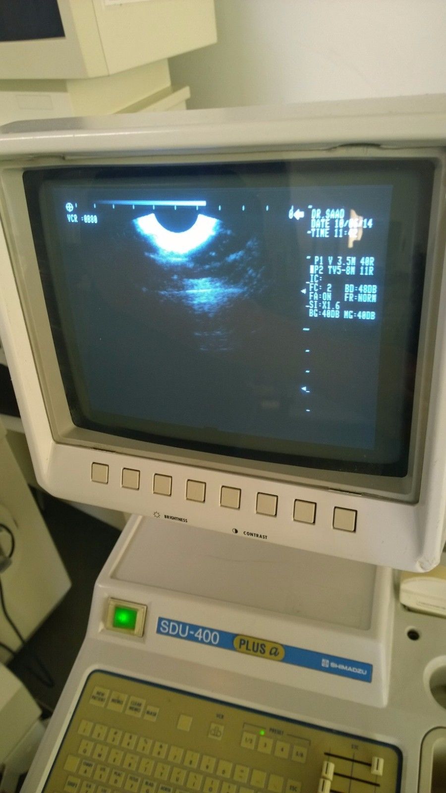 Shimadzu SDU-400 XP  2003 Ultrasound DIAGNOSTIC ULTRASOUND MACHINES FOR SALE