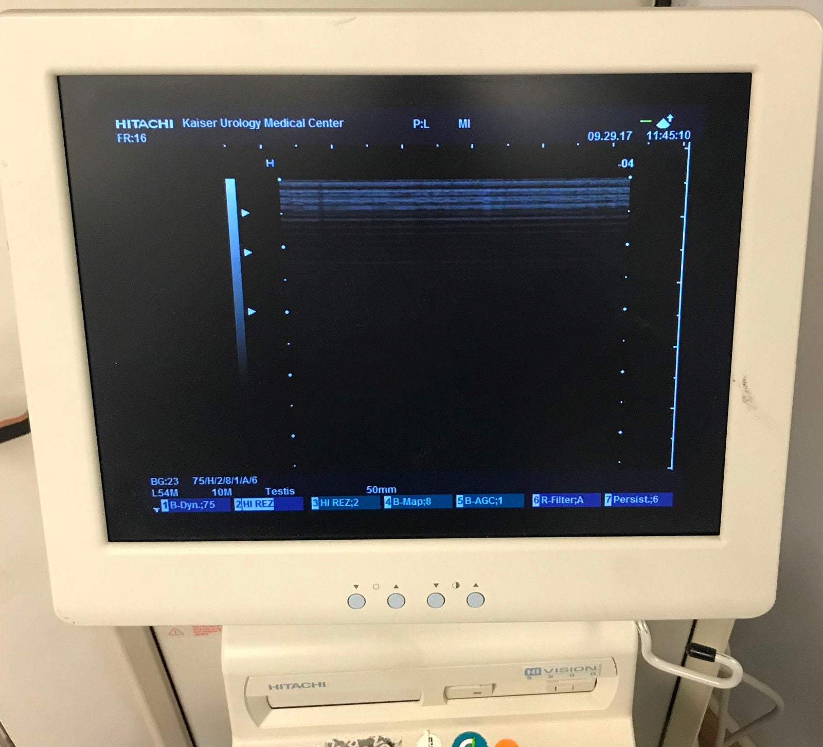 Hitachi HI Vision 5500 Ultrasound Diagnostic Scanner EUB-5500 w/ 3 Transducers DIAGNOSTIC ULTRASOUND MACHINES FOR SALE