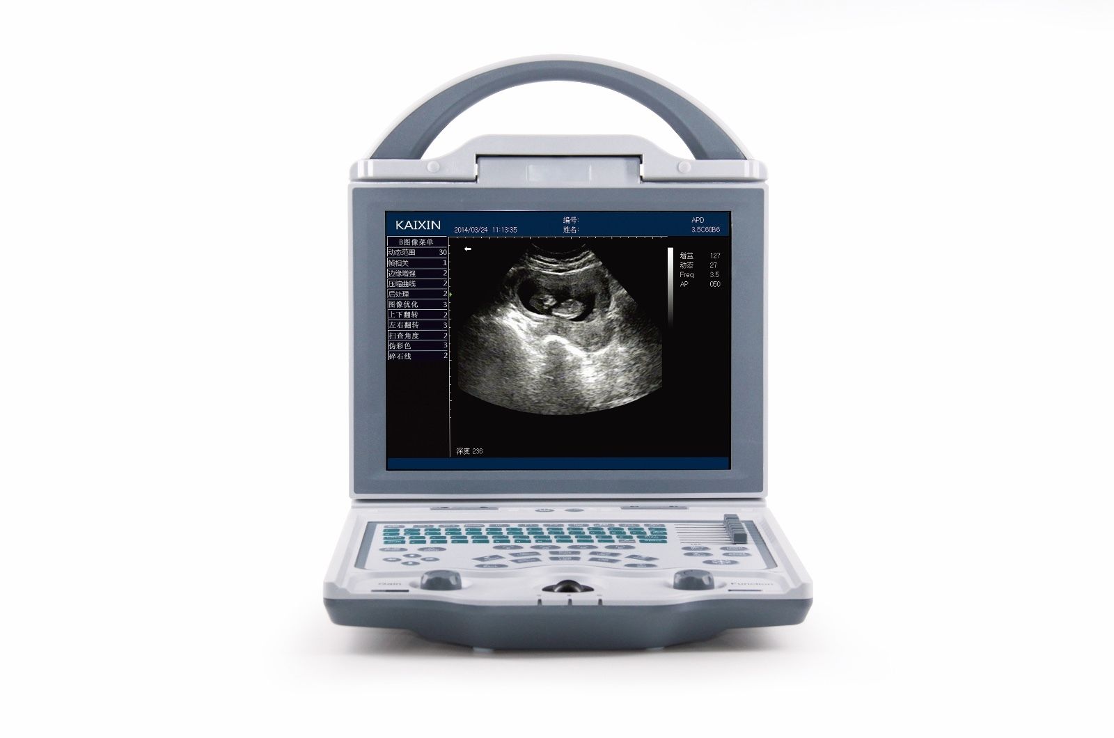 Biim Device Newest-Light weight Portable Ultrasound&one Probe, DICOM, Battery, LED
