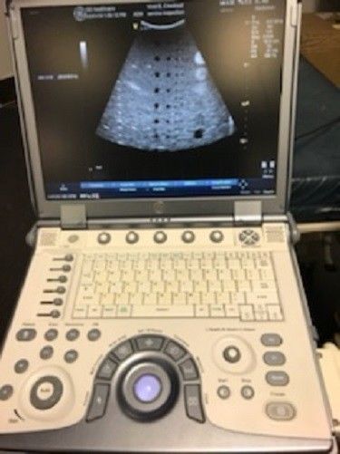 GE Vivid E Cardiac/Vascular/General Portable Ultrasound with 4 probes