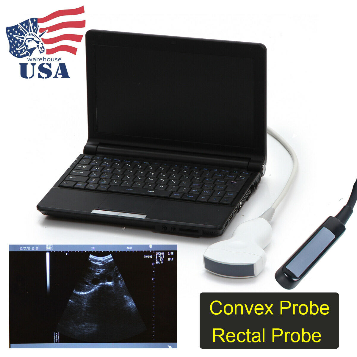 10" Portable Full Digital Laptop Ultrasound Scanner Machine +Convex Rectal Probe DIAGNOSTIC ULTRASOUND MACHINES FOR SALE
