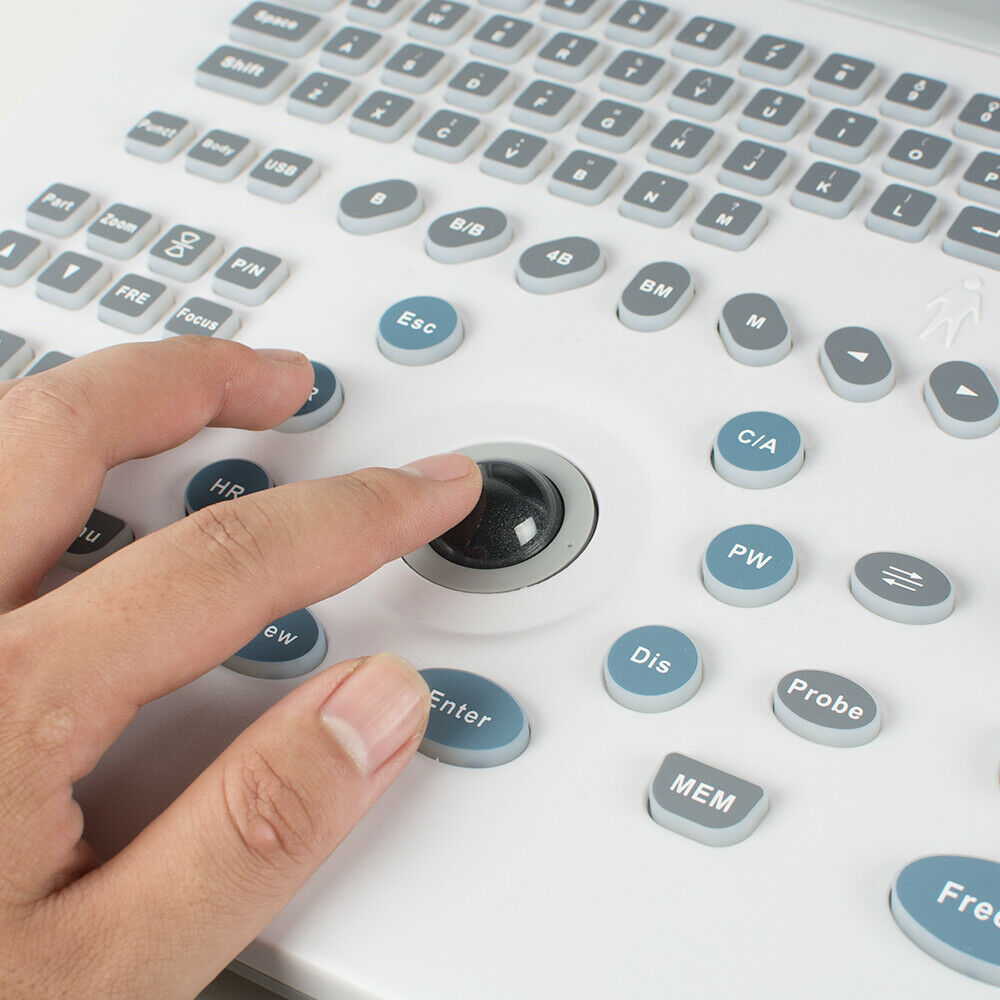 LCD Full Digital Portable Ultrasound Scanner Machine +7.5 Transvaginal Probe +3D DIAGNOSTIC ULTRASOUND MACHINES FOR SALE