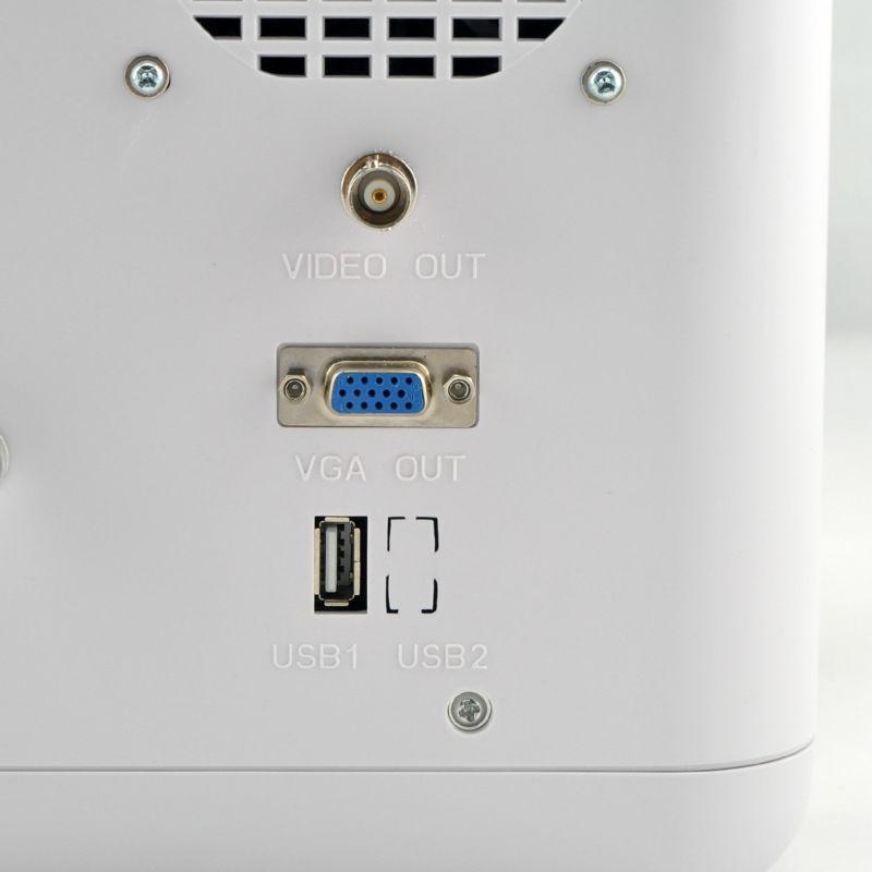 Medical Digital Ultrasound Scanner Machine 6.5Mhz Transvaginal Probe 3D CE Sale 190891224682 DIAGNOSTIC ULTRASOUND MACHINES FOR SALE