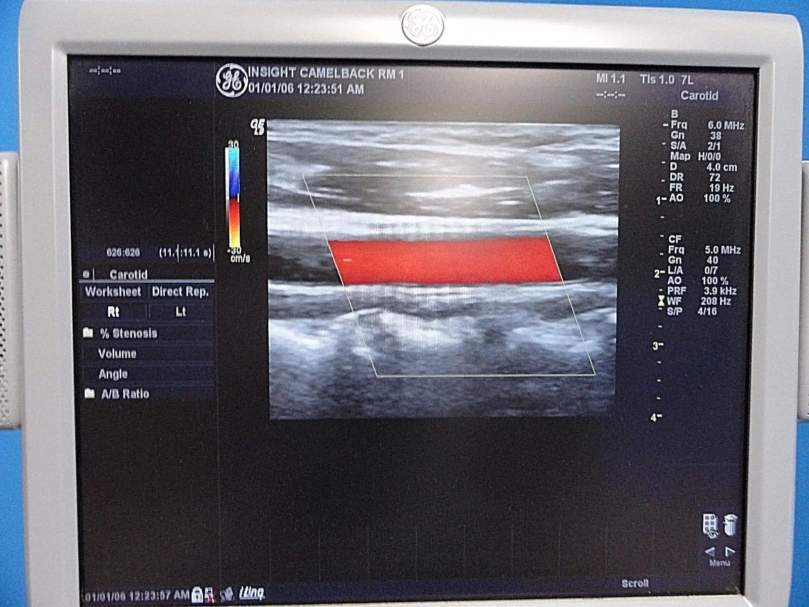 GE  7L / 2302648 Linear Array Ultrasound Probe for Logiq & Vivid Series~13787 DIAGNOSTIC ULTRASOUND MACHINES FOR SALE