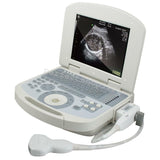 Top sale Ultrasound Scanner Diagnostic Ultrasonic Machine 3D Convex Transducer