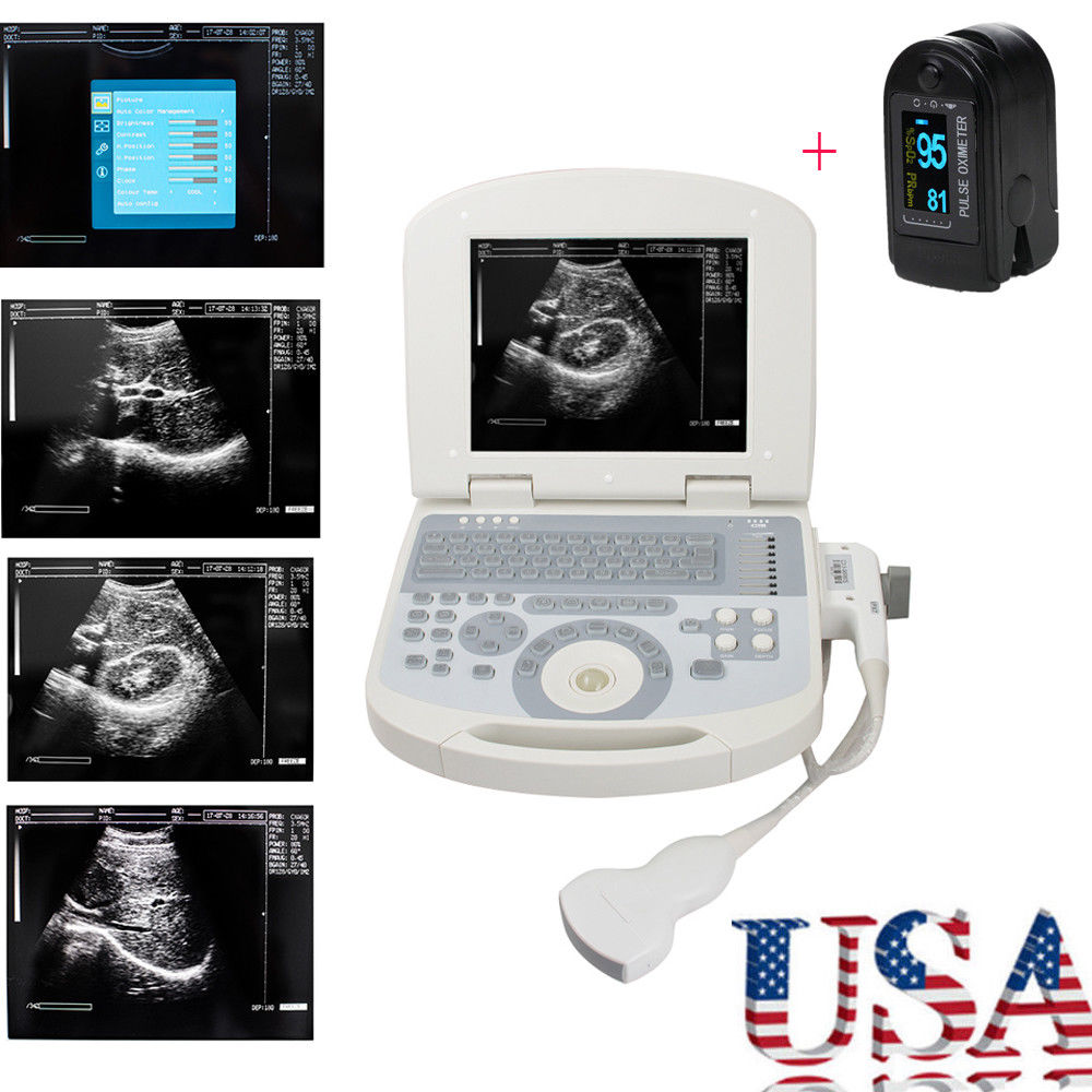 US Clear Portable Digital Laptop Medical Ultrasound Scanner Convex Probe 3D Gift 190891422491 DIAGNOSTIC ULTRASOUND MACHINES FOR SALE