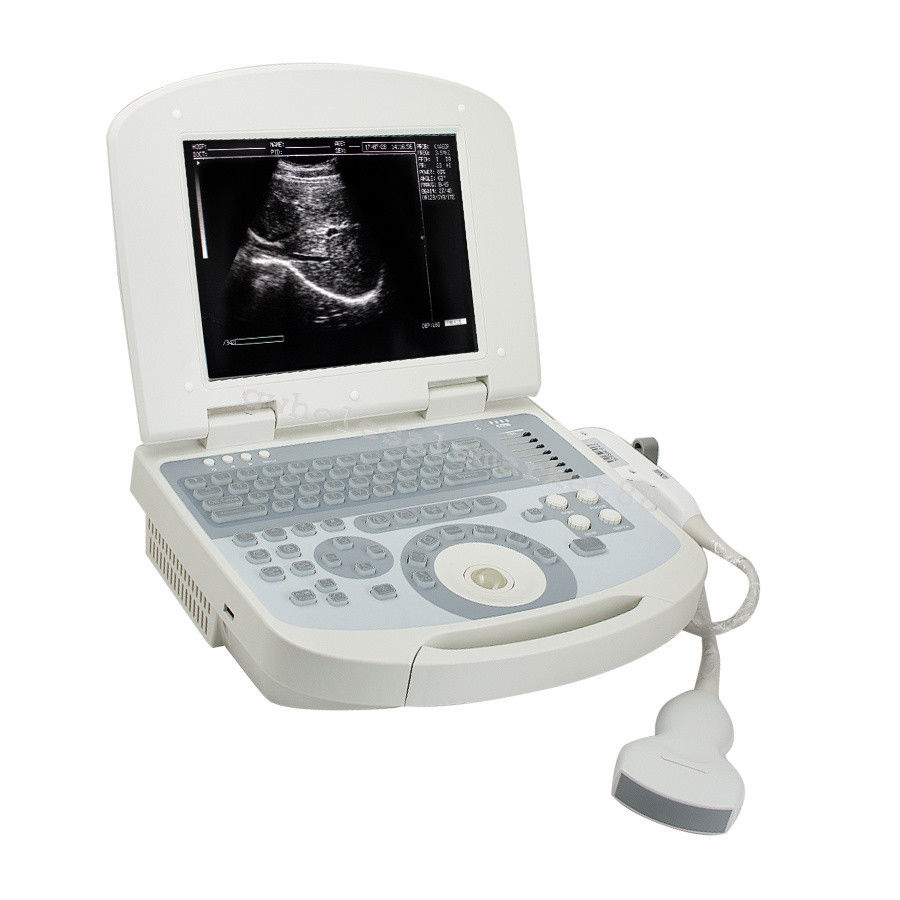 Laptop Ultrasound Machine Scanner Convex Probe 3D Software High Resolution Clear 190891045898 DIAGNOSTIC ULTRASOUND MACHINES FOR SALE