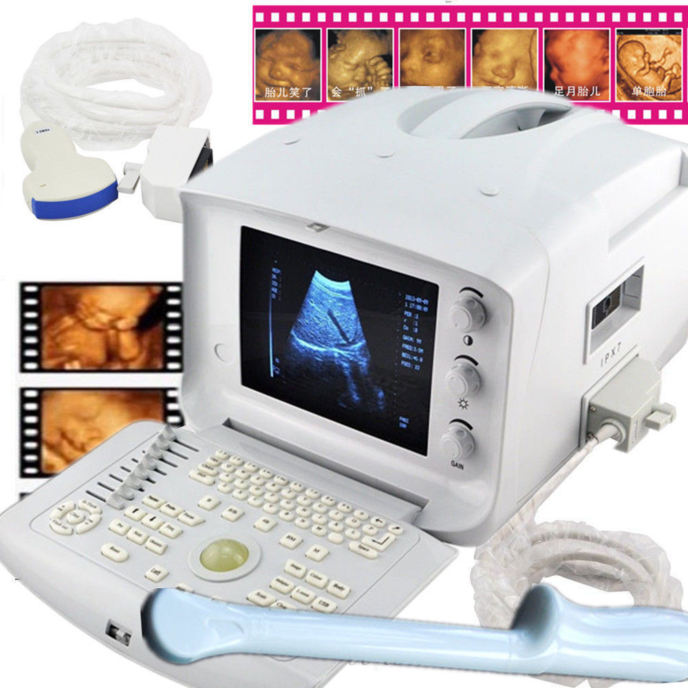 Transvaginal Machine Top Ultrasound Scanner for Abdomen & Gynecology