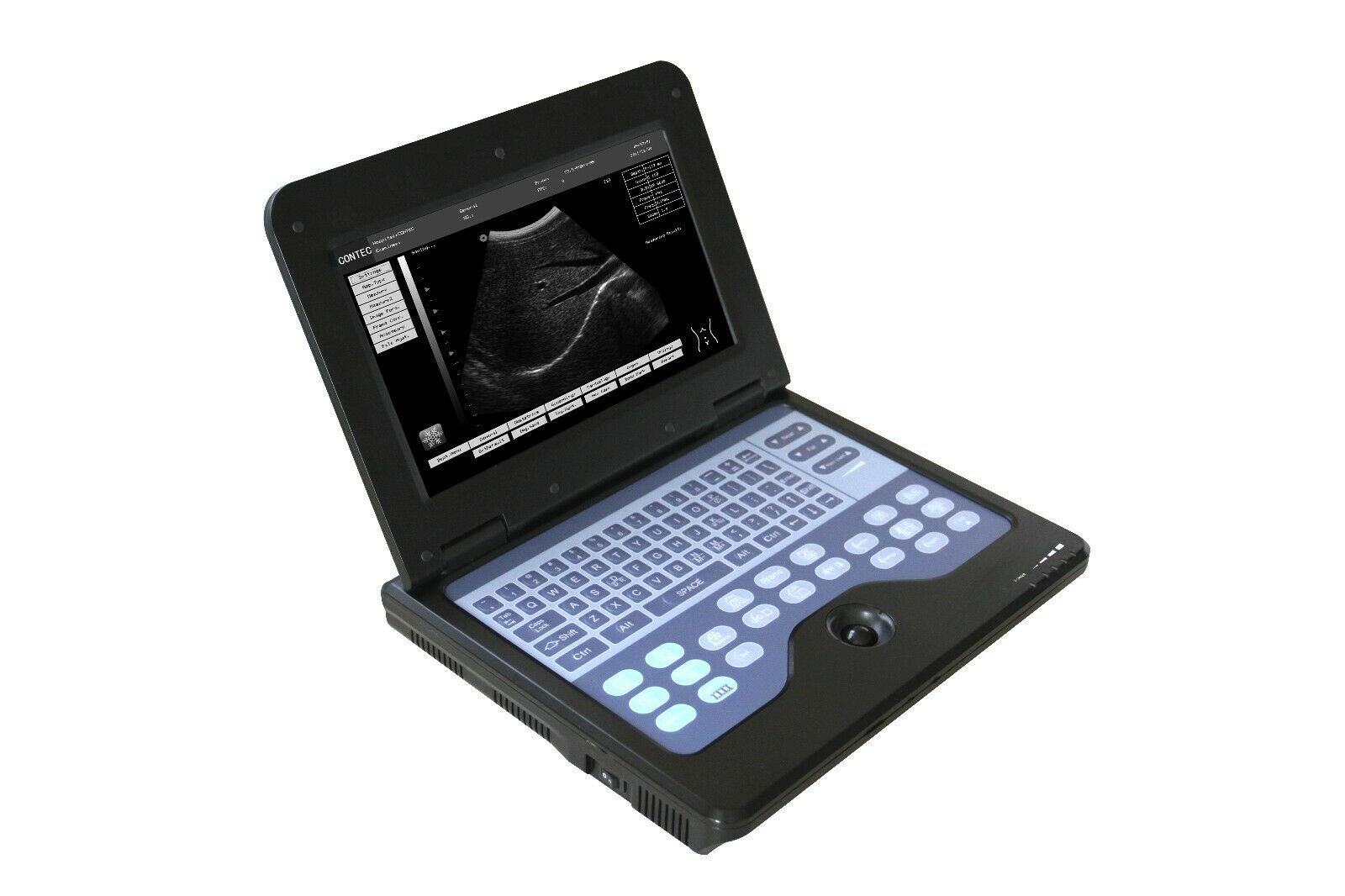 Portable Ultrasound Scanner Diagnostic Ultrasound Machine Convex+Transvaginal US DIAGNOSTIC ULTRASOUND MACHINES FOR SALE
