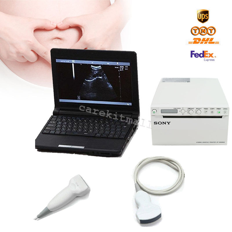 Laptop LCD Ultrasound Scanner Machine +Convex Linear Probe+Sony UP-897MD Printer 190891494573 DIAGNOSTIC ULTRASOUND MACHINES FOR SALE