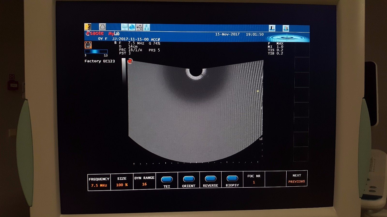 Biosound / Esaote MyLab 20 Diagnostic Ultrasound unit OB / GYN DIAGNOSTIC ULTRASOUND MACHINES FOR SALE