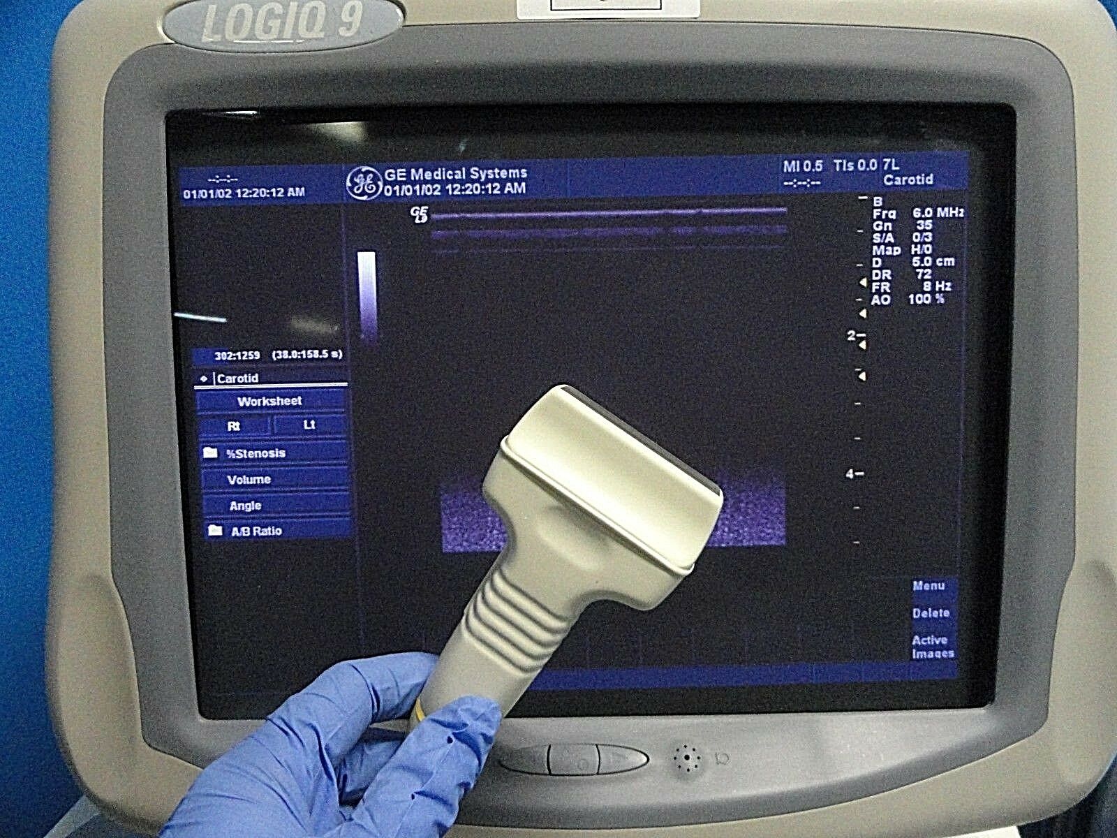 2011 GE 7L  P/N 2302648 Linear Ultrasound Probe For Logiq & Vivid Series~16678 DIAGNOSTIC ULTRASOUND MACHINES FOR SALE
