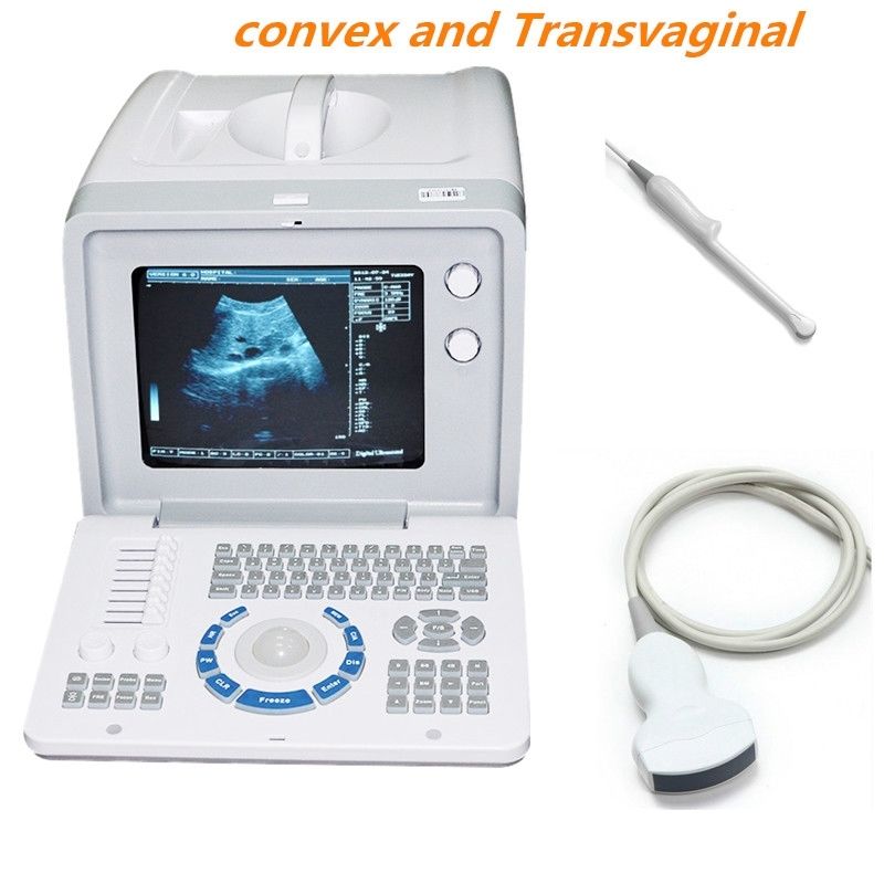 Top CE Full Digital Ultrasound Machine Covex+Transvaginal Probe 3D