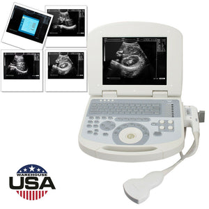 USA 10.4 inch Digital Laptop Medical Ultrasound Scanner 3.5MHZ Convex Probe USA