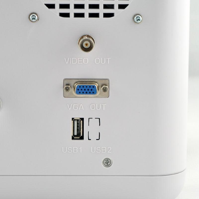 Digital Scan Ultrasound Scanner Machine+3 probes CONVEX, LINEAR, TV +Free 3D UPS DIAGNOSTIC ULTRASOUND MACHINES FOR SALE