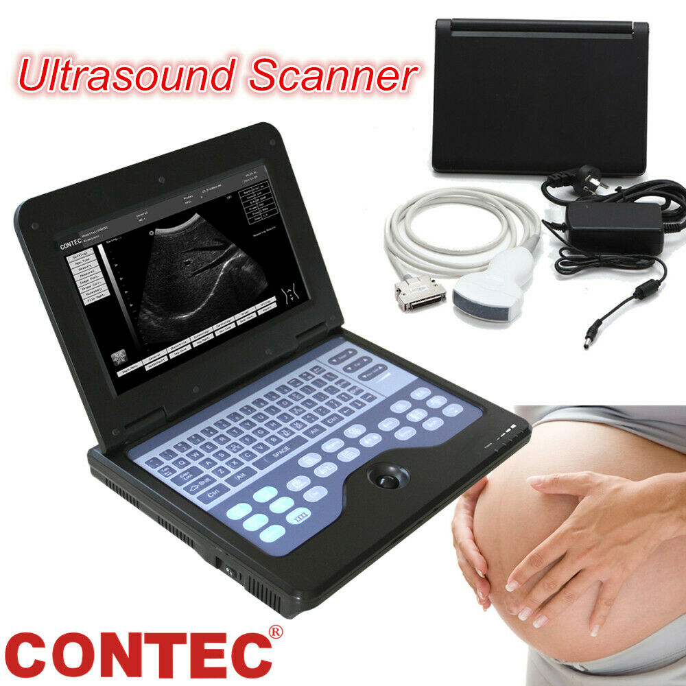 Digital B-Ultrasound Scanner Portable Machine +Convex Abdominal Ultrasound Probe DIAGNOSTIC ULTRASOUND MACHINES FOR SALE