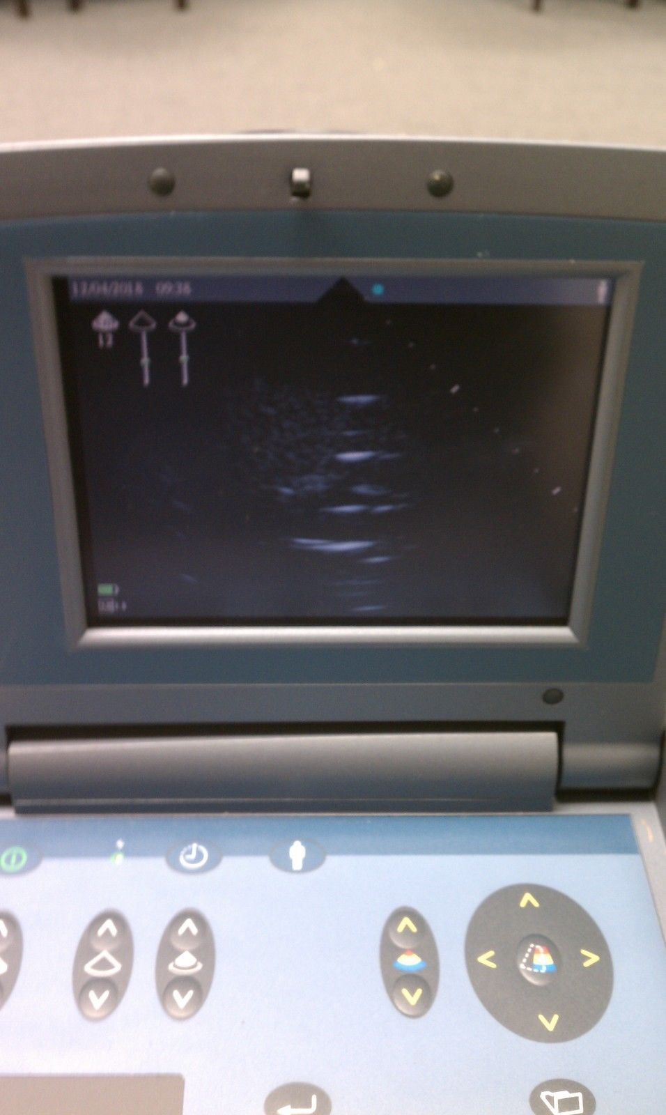 closeup of ultrasound monitor