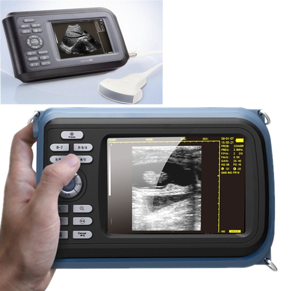 US! Diagnostic Machine Ultrasound Scanner System Convex Probe Abdominal Hospital DIAGNOSTIC ULTRASOUND MACHINES FOR SALE