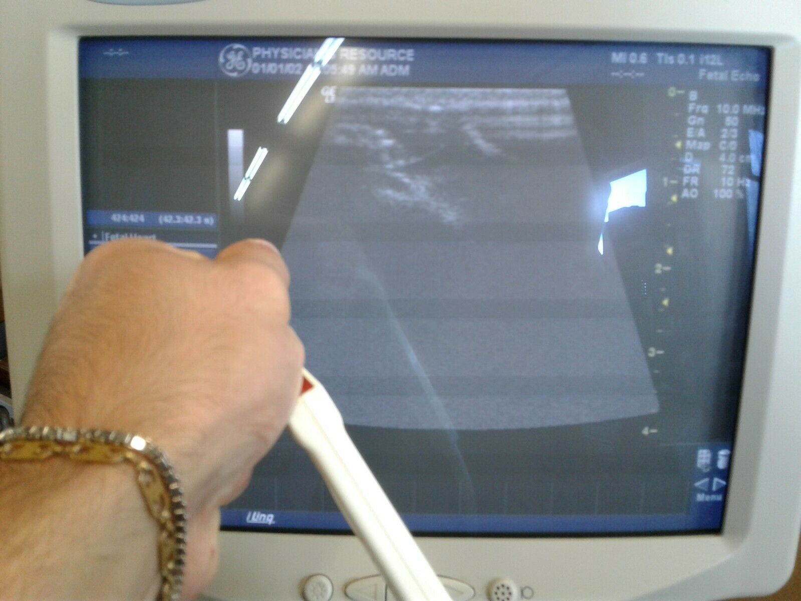 GE i12L Intraoperative Ultrasound Linear Array Transducer Probe - TESTED DIAGNOSTIC ULTRASOUND MACHINES FOR SALE