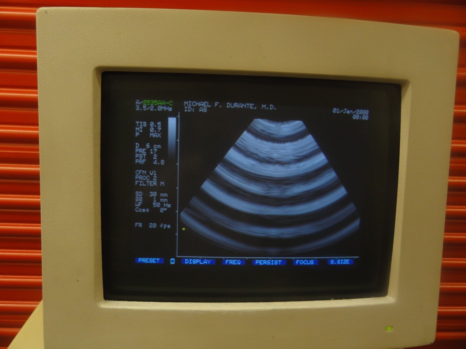 Biosound Esaote AU3 P/N 7050 Ultrasound W/ LA 13 & 2535AA-C Probe&