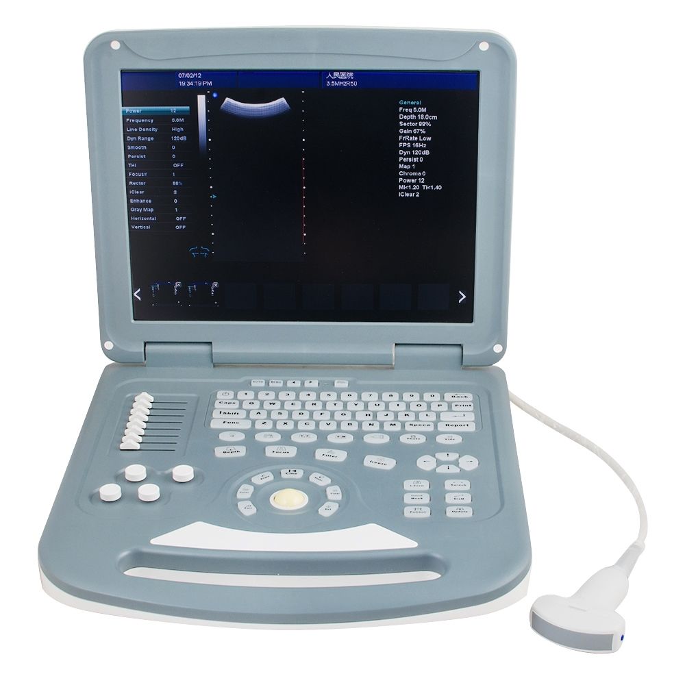 15"  Doppler Ultrasound Diagnostic System Scanner Convex Transvaginal 2 Probe A+ 190891646774 DIAGNOSTIC ULTRASOUND MACHINES FOR SALE