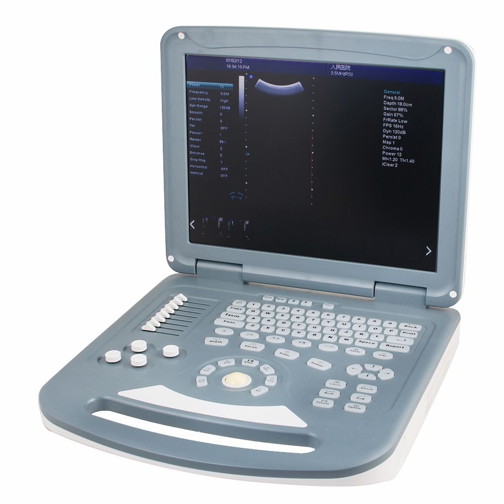 15" Color Doppler Ultrasound Diagnostic System Scanner Convex+ linear 2 Probe A+ 190891730787 DIAGNOSTIC ULTRASOUND MACHINES FOR SALE