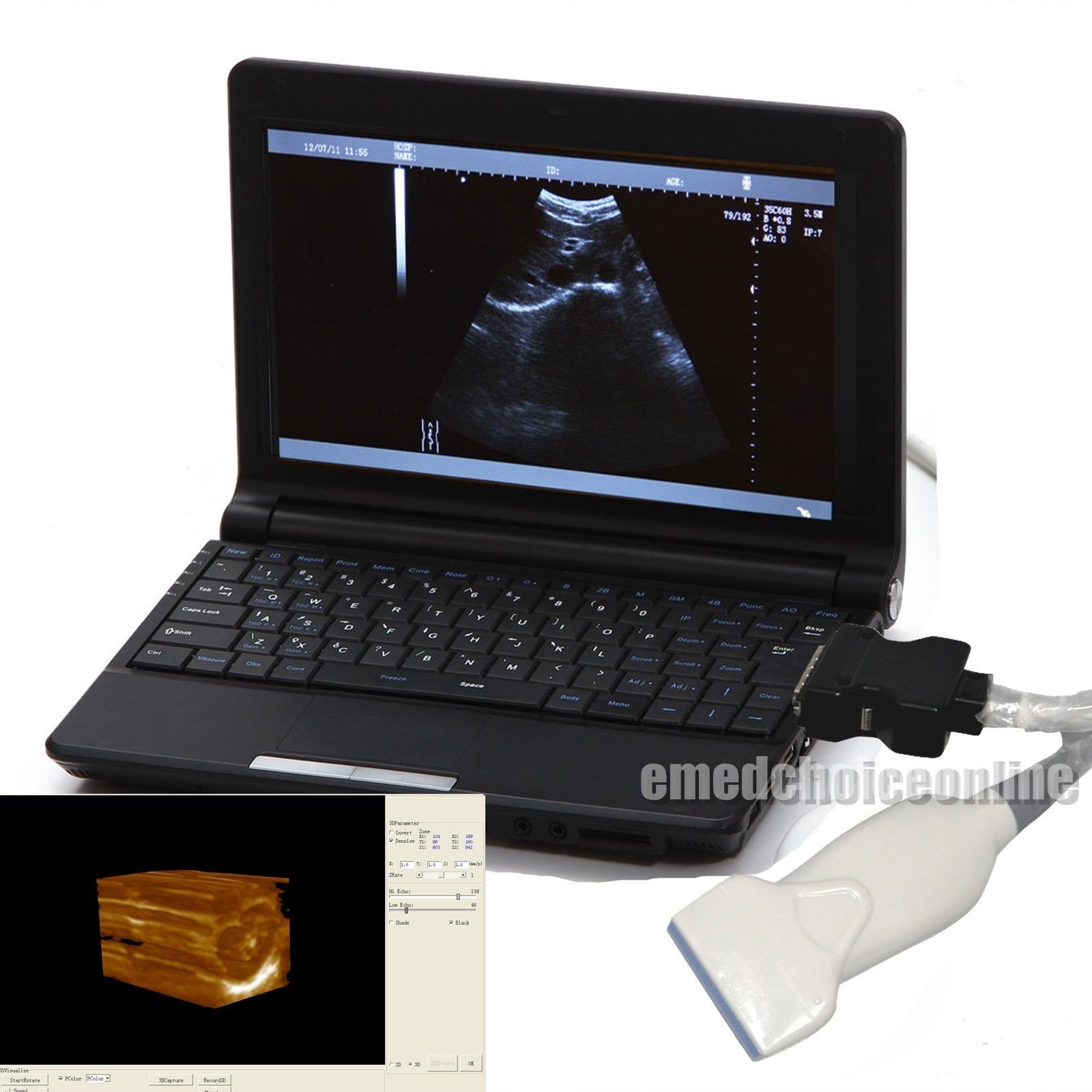 Medical Portable Notebook Laptop Ultrasound Scanner Digital 6.5Mhz Linear Probe 190891866813 DIAGNOSTIC ULTRASOUND MACHINES FOR SALE