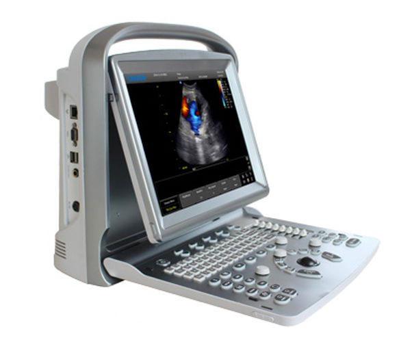 Affordable Color Doppler Ultrasound Machine Chison ECO5 With One Probe DIAGNOSTIC ULTRASOUND MACHINES FOR SALE
