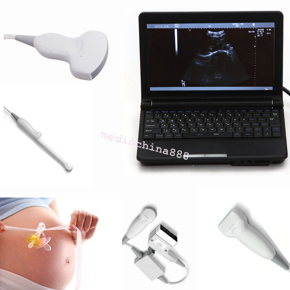 10.1'' Ultrasound Scanner With Convex+Linear+Transvaginal+Micro-Convex Probe Bid DIAGNOSTIC ULTRASOUND MACHINES FOR SALE