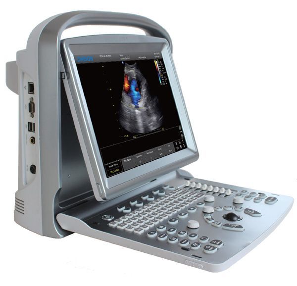 Color Doppler Ultrasound Scanner with Two Probes, Battery - Chison ECO5-Vascular DIAGNOSTIC ULTRASOUND MACHINES FOR SALE