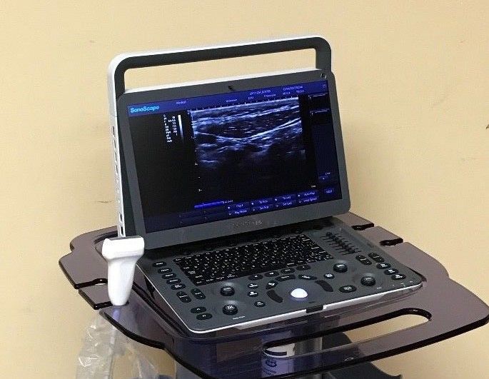Sonoscap E1 Portable Ultrasound machine with Linear array probe DIAGNOSTIC ULTRASOUND MACHINES FOR SALE
