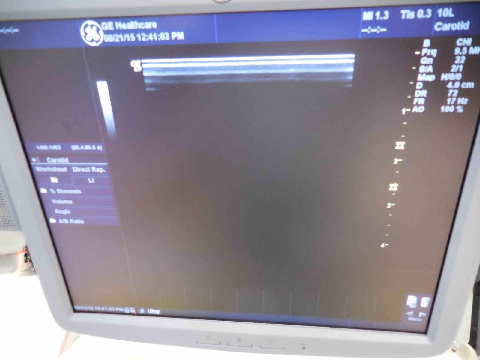 GE Logiq 9 LCD Ultrasound System
