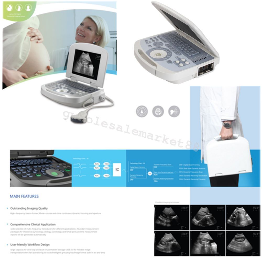 USA +3D Portable Machine Digital Ultrasound Scanner System 3.5MHZ Convex Probe DIAGNOSTIC ULTRASOUND MACHINES FOR SALE