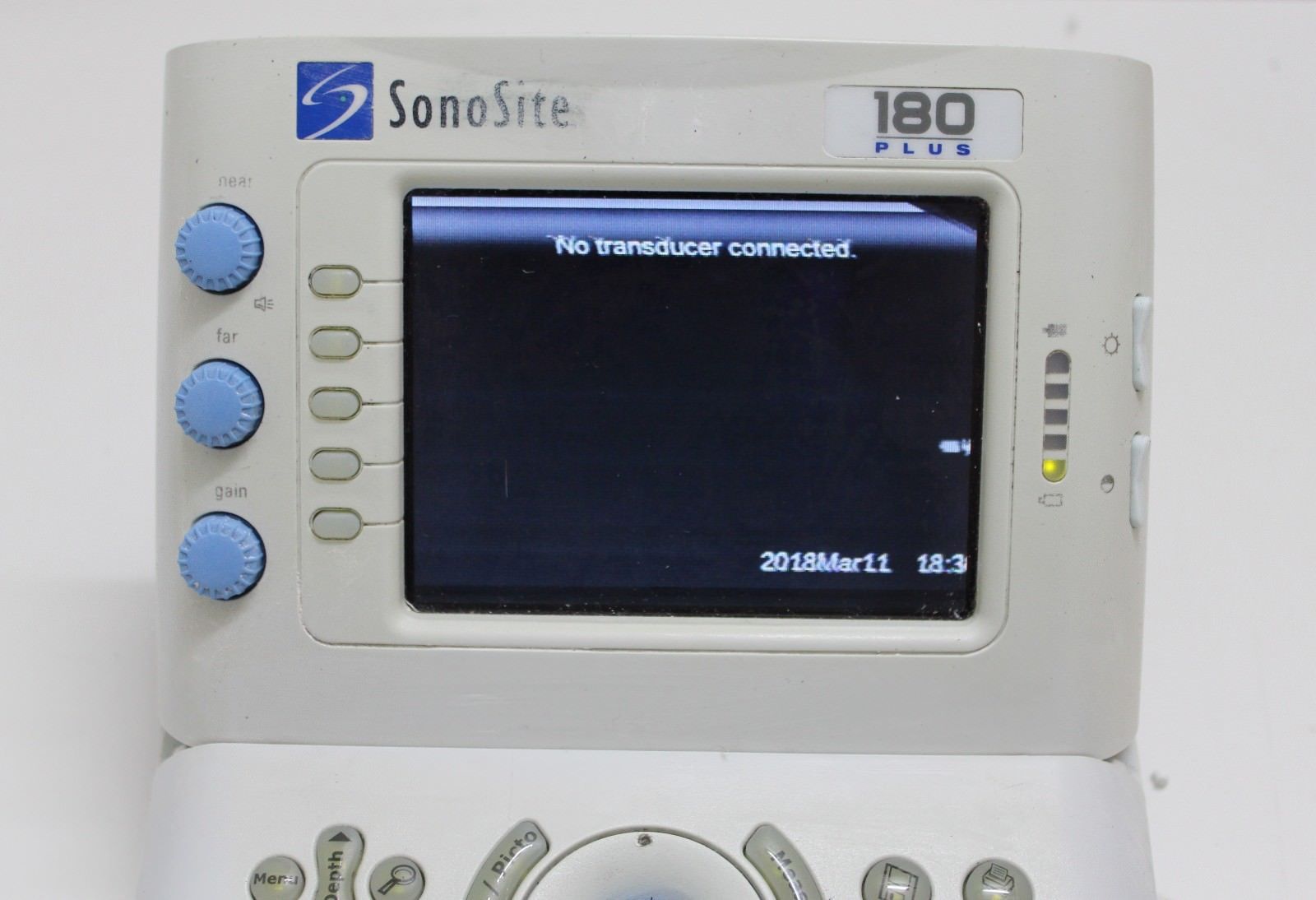 Sonosite 180 Plus Ultrasound (please read) DIAGNOSTIC ULTRASOUND MACHINES FOR SALE