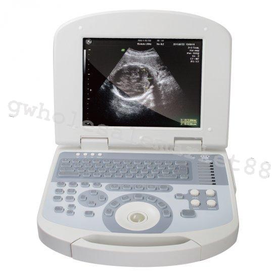 USA High Resolution Laptop Medical Ultrasound Scanner Convex probe +3D Software 190891422491 DIAGNOSTIC ULTRASOUND MACHINES FOR SALE