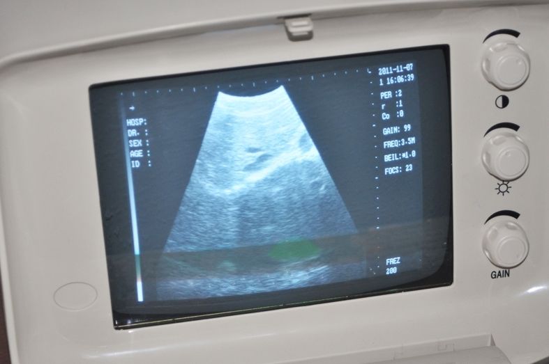 Portable Digital Ultrasound Scanner machine + Linear Probe Shallow Layer 3D Sale 190891928498 DIAGNOSTIC ULTRASOUND MACHINES FOR SALE