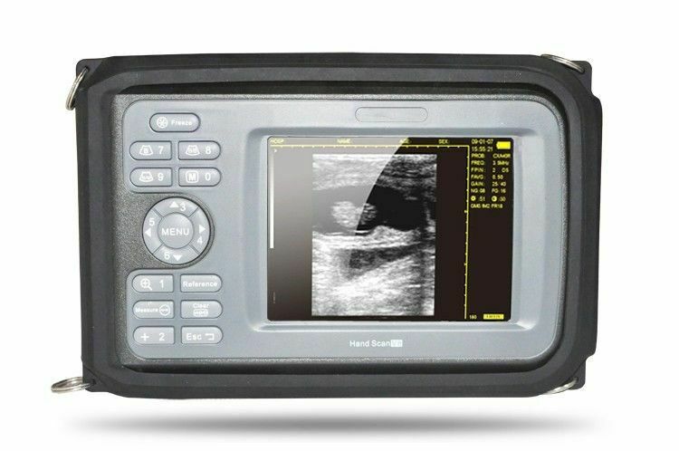 Portable Ultrasound Scanner/Machine Convex Transducer For Human 100% Warranty DIAGNOSTIC ULTRASOUND MACHINES FOR SALE