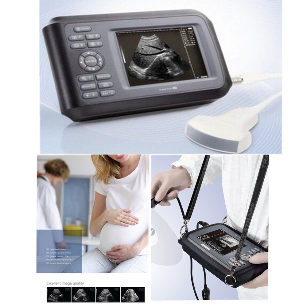 USA Big 5.5" Portable Diagnostic Ultrasound Machine Scanner System Convex Probe DIAGNOSTIC ULTRASOUND MACHINES FOR SALE