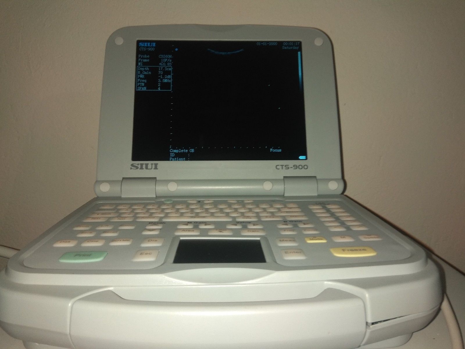 USG UltraSound SIUI CTS-900 DIAGNOSTIC ULTRASOUND MACHINES FOR SALE