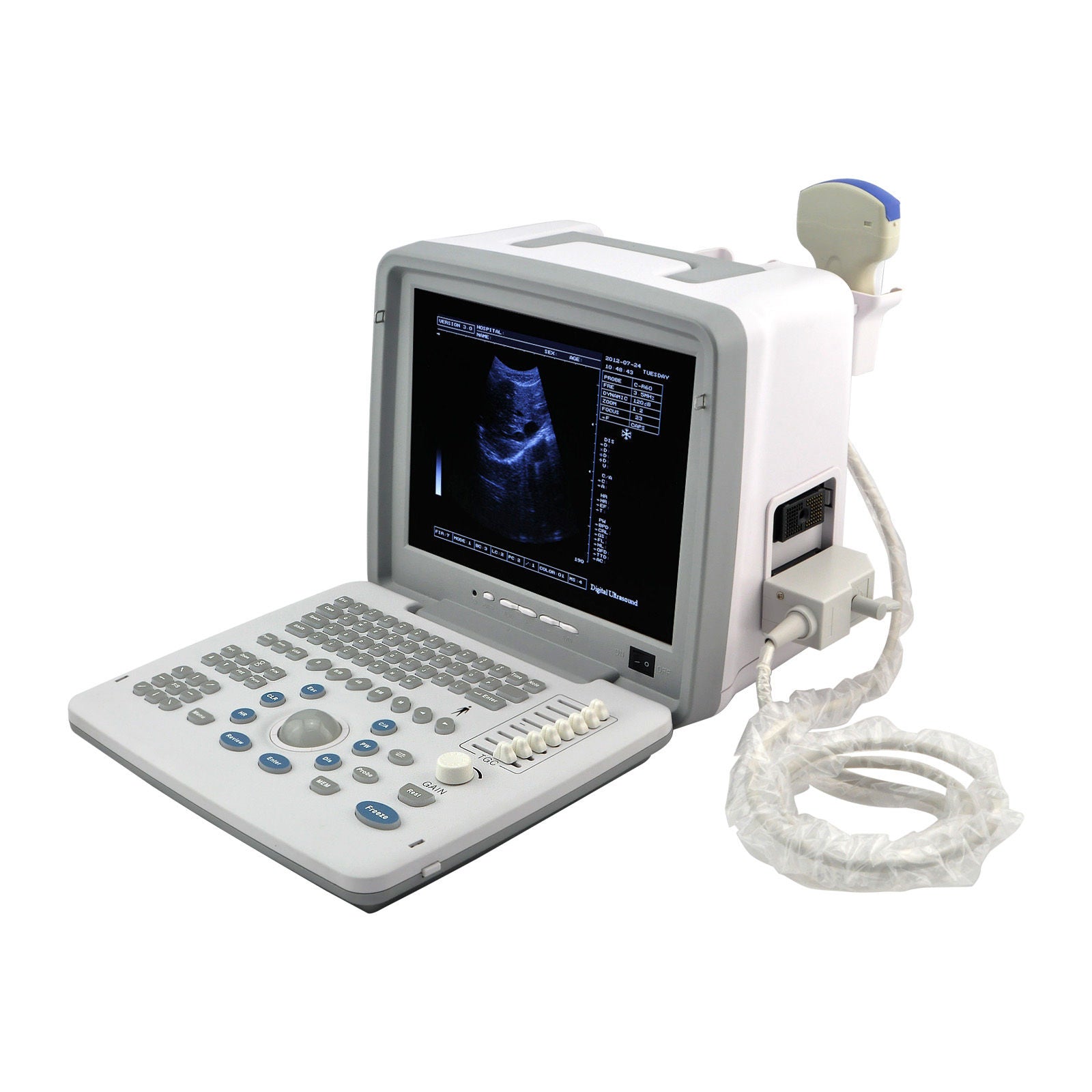 Professional Portable Ultrasound Scanner System Convex +Transvaginal Probe + 3D DIAGNOSTIC ULTRASOUND MACHINES FOR SALE