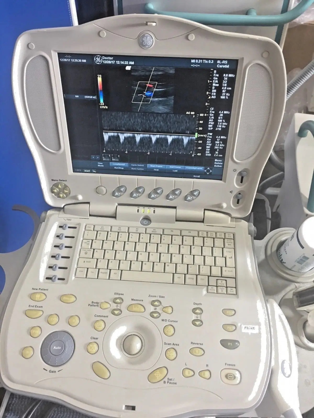 GE LogiqBook XP Porable Ultrasound with 3 transducers & Cart