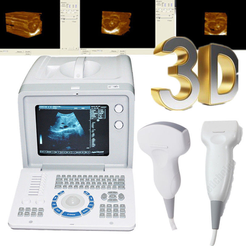 Sonogram Writing Machine Portable Digital Ultrasound Scanner Machine 3.5MHZ Convex 7.5mhz