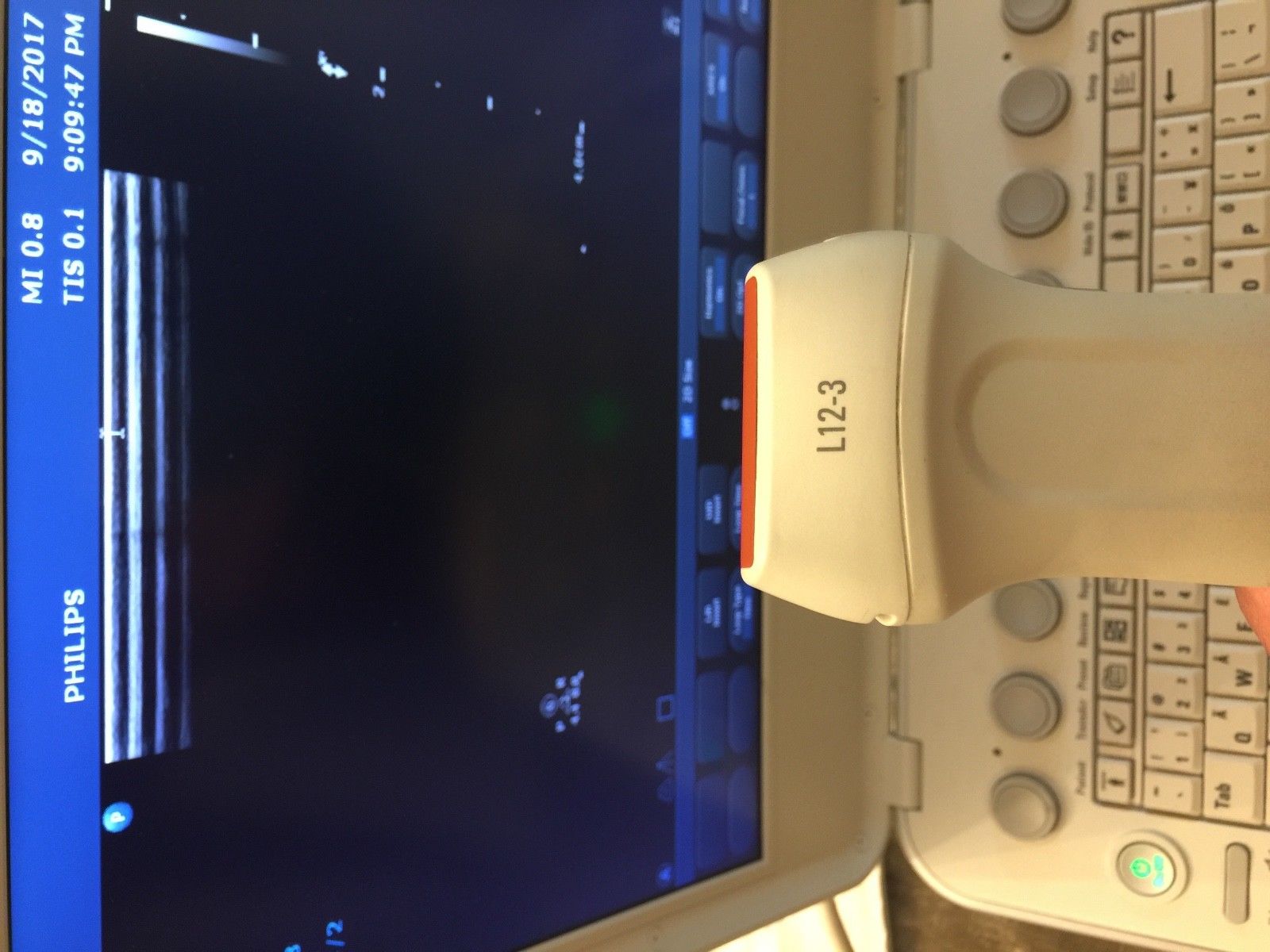 Philips L12-3 Vascular Linear MSK Ultrasound Transducer for CX50.